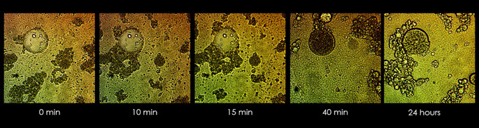 image p5 retention of anods in cell wall